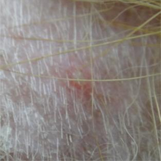 犬アトピー性皮膚炎の症例に認められた膿皮症