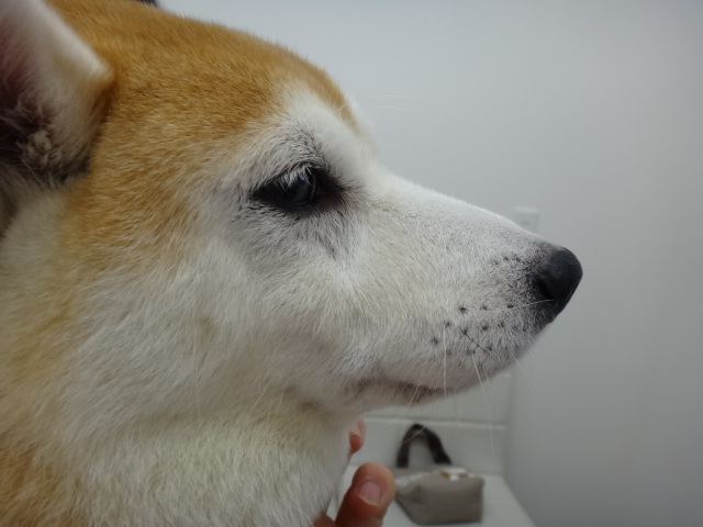 アトピー性皮膚炎2