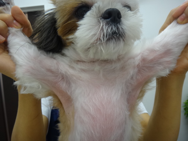アトピー性皮膚炎の特2