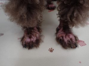 心因性掻痒症1